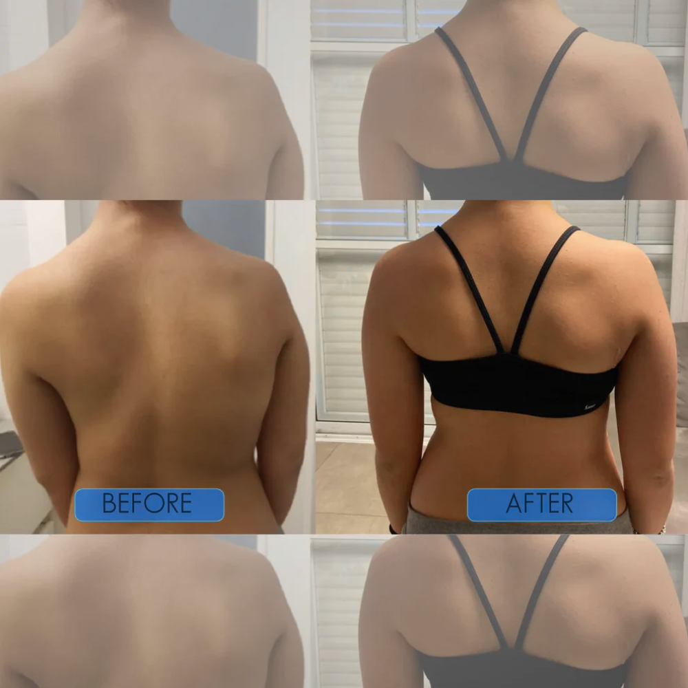 Handeelife™ Instant Posture Corrector