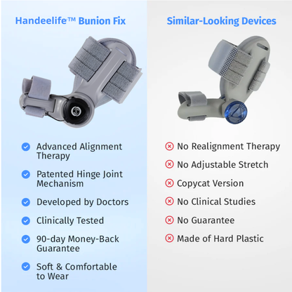 Handeelife™ Bunion Fix – Non-Surgical Bunion Corrector (Clinically Proven)