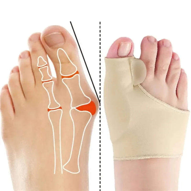 Handeelife™ Orthopedic Daytime Bunion Sleeve