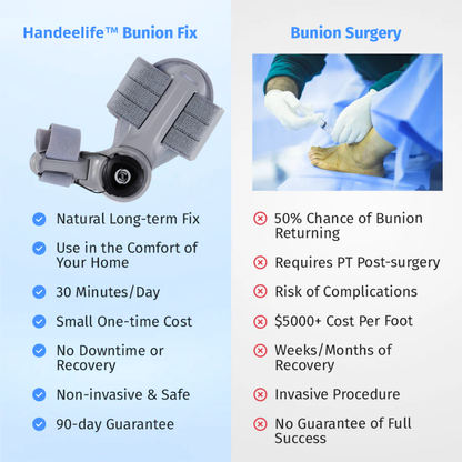 Handeelife™ Bunion Fix – Non-Surgical Bunion Corrector (Clinically Proven)