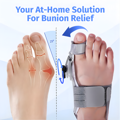 Handeelife™ Bunion Fix – Non-Surgical Bunion Corrector (Clinically Proven)