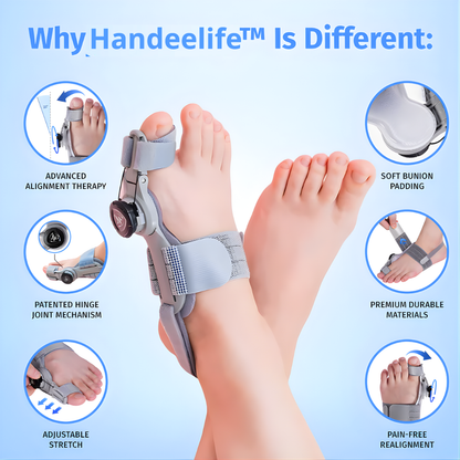 Handeelife™ Bunion Fix – Non-Surgical Bunion Corrector (Clinically Proven)